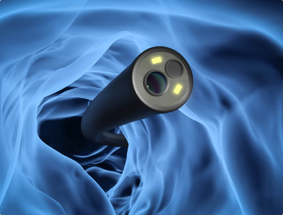 鼹鼠医疗和您探讨:一次性支气管镜的优势 鼹鼠医疗和您探讨:一次性支气管镜的优势